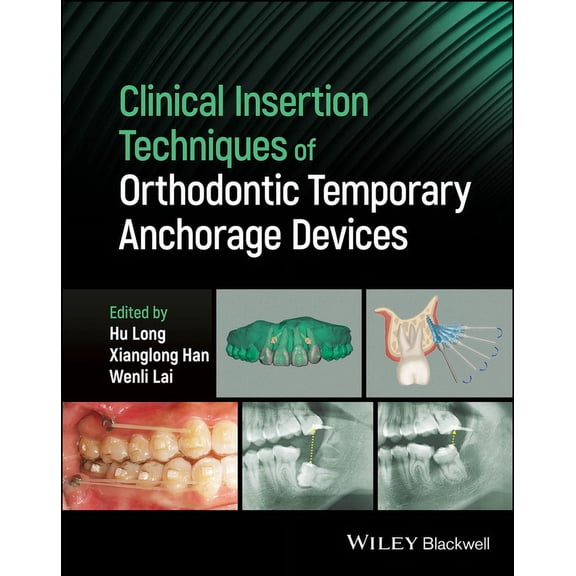 Clinical Insertion Techniques of Orthodontic Temporary Anchorage Devices (Hardcover)