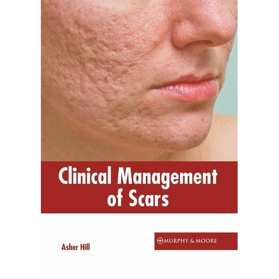 Clinical Management of Scars, (Hardcover)