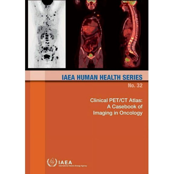 Clinical Pet/Ct Atlas: A Casebook Of Imaging In Oncology : IAEA Human Health Series No.32 (Paperback)