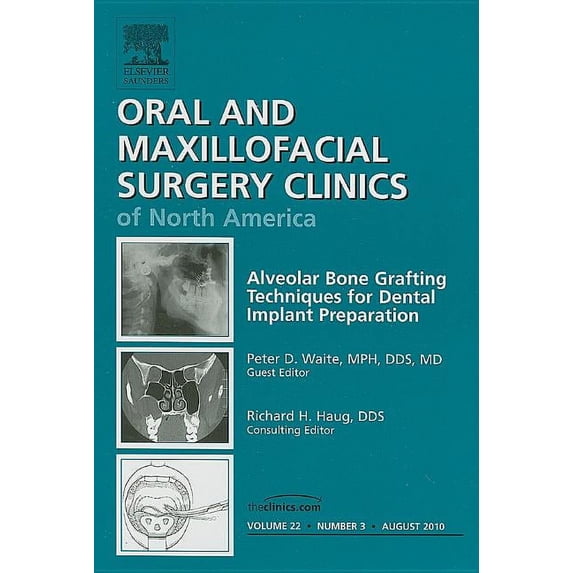 Clinics: Dentistry: Alveolar Bone Grafting Techniques for Dental Implant Preparation, an Issue of Oral and Maxillofacial Surgery Clinics: Volume 22-3 (Hardcover)
