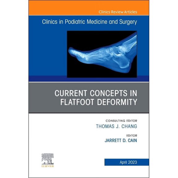 Clinics: Orthopedics Current Concepts in Flatfoot Deformity, an Issue of Clinics in Podiatric Medicine and Surgery: Volume 40-2, Book 40, (Hardcover)