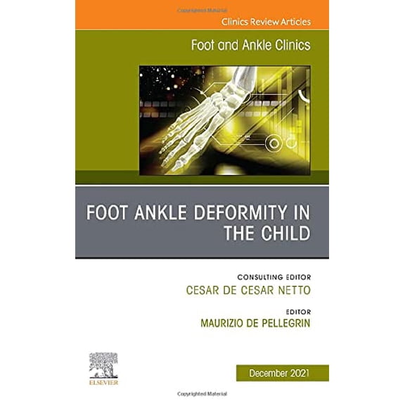 Pre-Owned Clinics: Orthopedics Foot Ankle Deformity in the Child, an Issue of Foot and Ankle Clinics of North America: Volume 26-4, Book 26, (Hardcover)