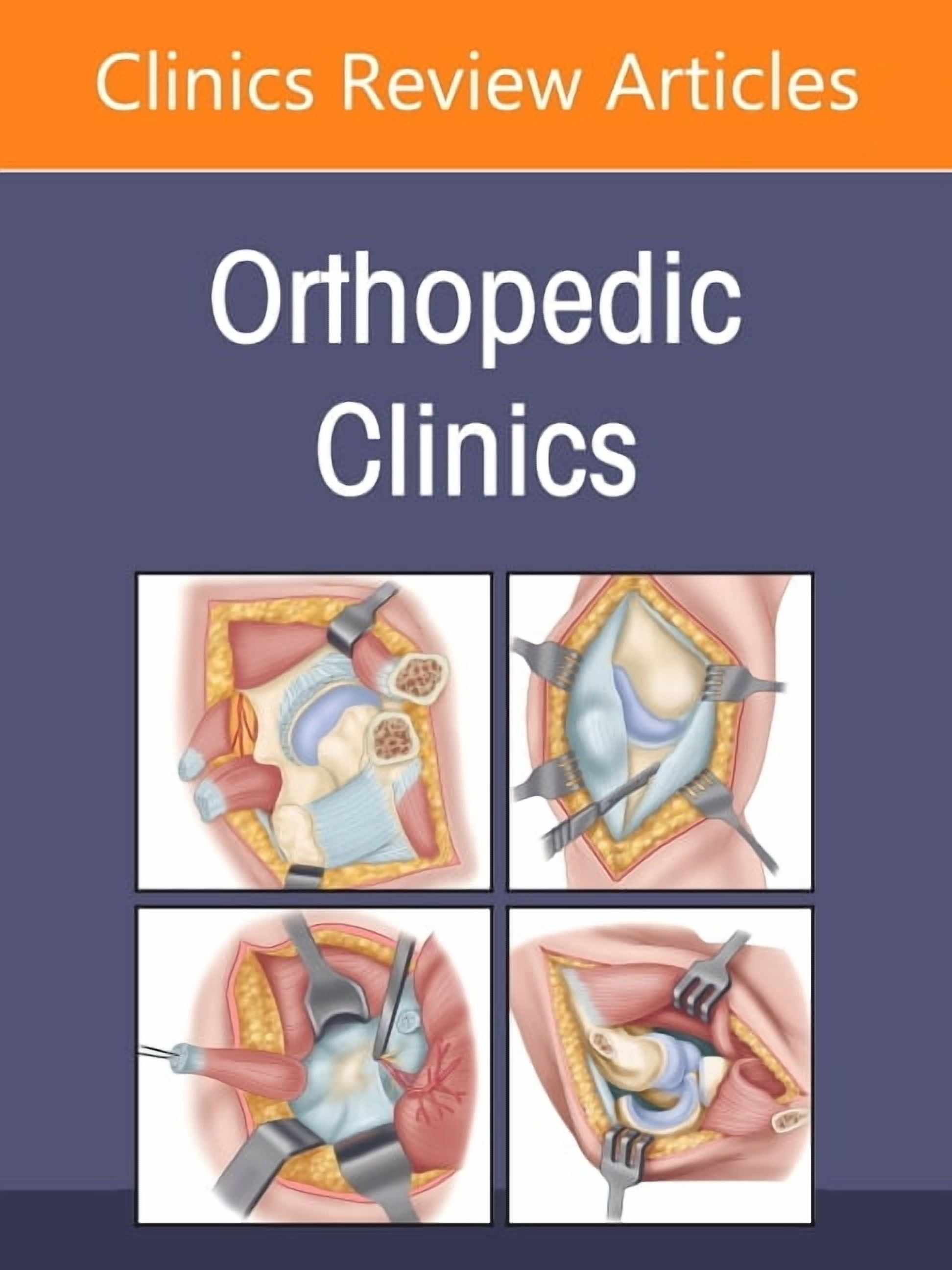 Clinics: Orthopedics Minimally Invasive Surgery, an Issue of Orthopedic Clinics: Volume 58-1, Book 58, (Hardcover)