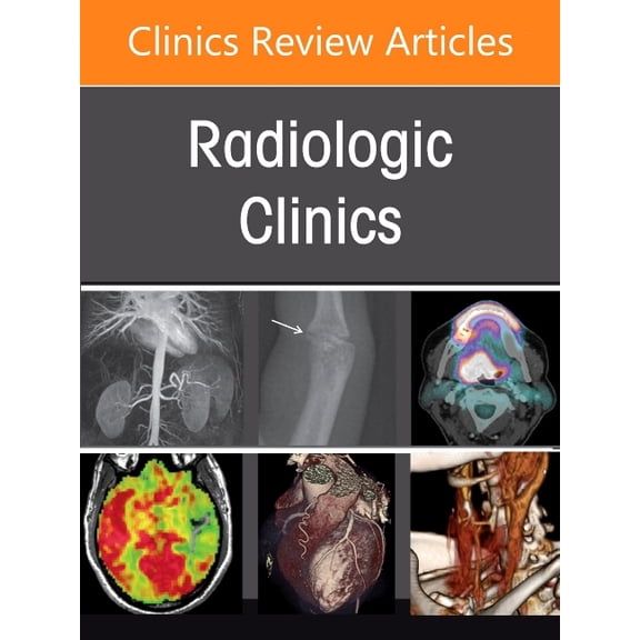 Clinics: Radiology Current Pediatric and Adult Emergency Radiology Practice, an Issue of Radiologic Clinics of North America: Volume 65-1, Book 65, (Hardcover)