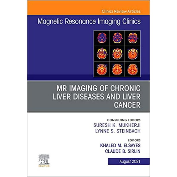 Pre-Owned MR Imaging of Chronic Liver Diseases and Liver Cancer, An Issue of Magnetic Resonance Imaging Clinics of North America (Volume 29-3) (The Clinics: Radiology, Volume 29-3), 9780323776134, 0323776132, H