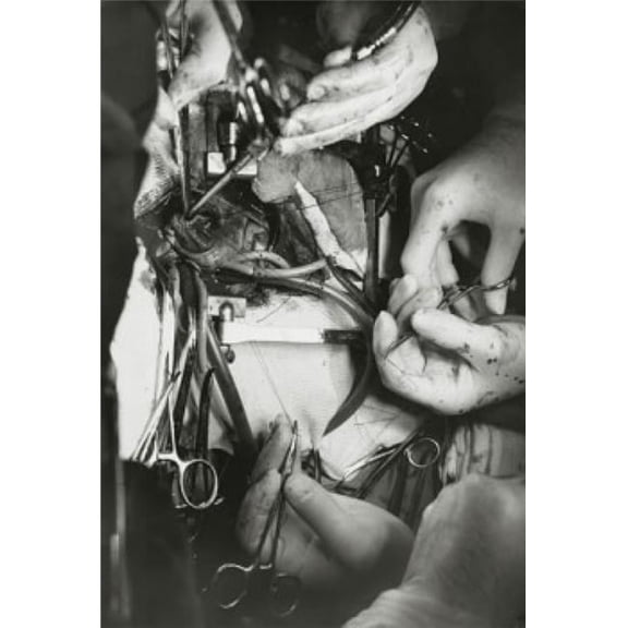 Close-Up of Surgeons Hands Performing Open-Heart Surgery Poster Print, 24 x 36 - Large