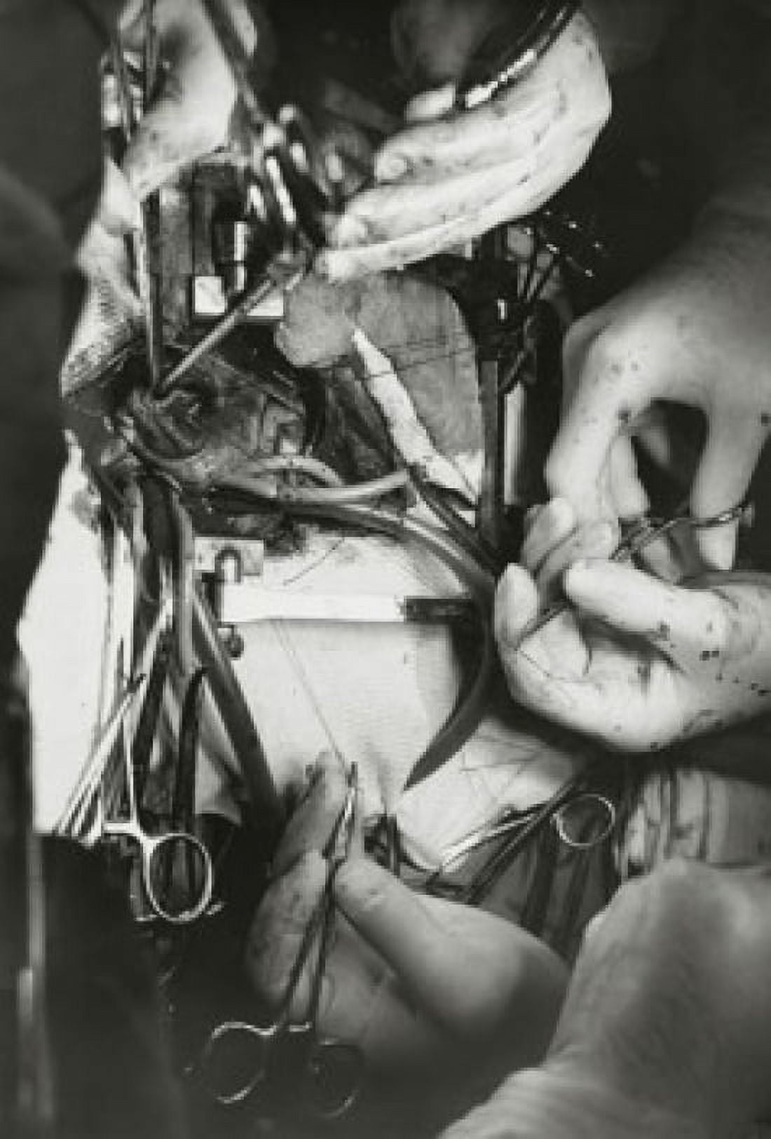 Close-up of surgeons hands performing open-heart surgery Canvas Art - (18 x 24)