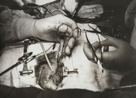 Close-up of surgeons hands performing open-heart surgery Canvas Art - (18 x 24)