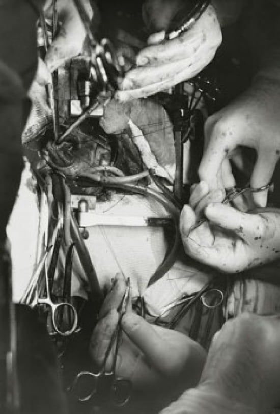 Close-up of surgeons hands performing open-heart surgery Canvas Art - (24 x 36)