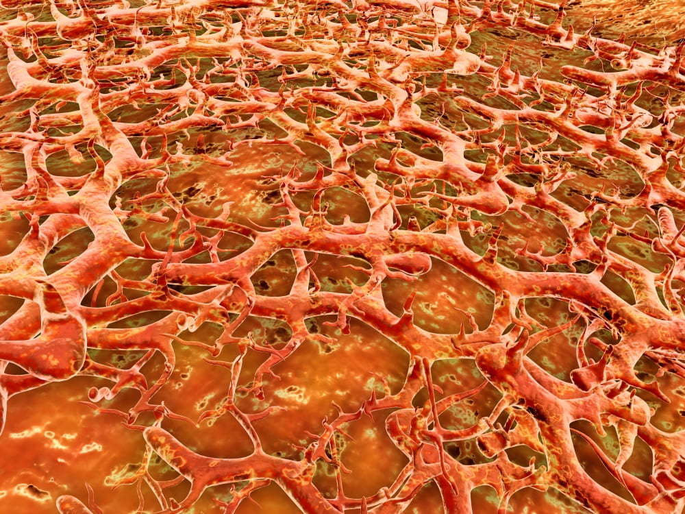 Close-up view of athletes foot fungus Canvas Art - Stocktrek Images (17 x 13)