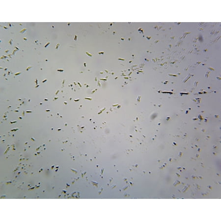 Clostridium Botulinum, Spore-Forming Anaerobic Rods; Smear; Gram-Positive by Go Science Crazy