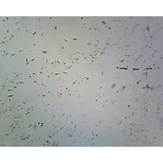 Clostridium Botulinum, Spore-Forming Anaerobic Rods; Smear; Gram-Positive by Go Science Crazy