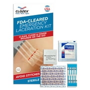 Clozex Emergency Laceration Kit - Repair Wounds Without Stitches, Skin Closure Device for a Wound Up to 1 1/2 Inches Length. Complete Kit to Clean, Close, Cover Wounds