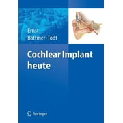 Cochlear Implant Heute, Paperback