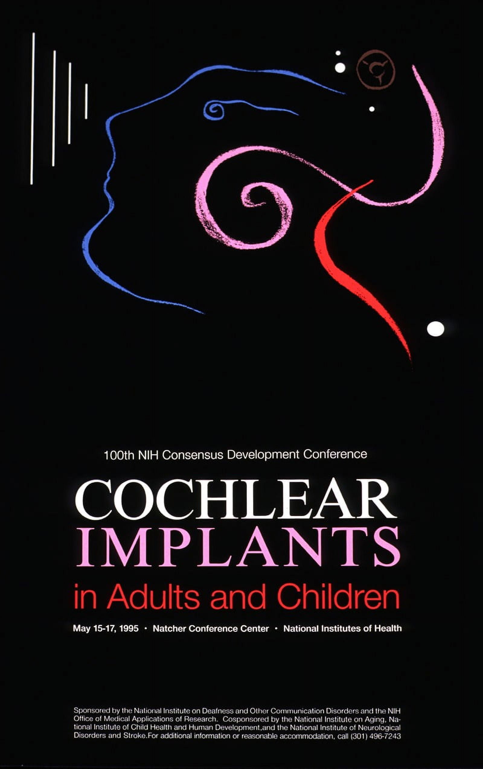 Cochlear implants in adults and children (1995) Poster Print by ...