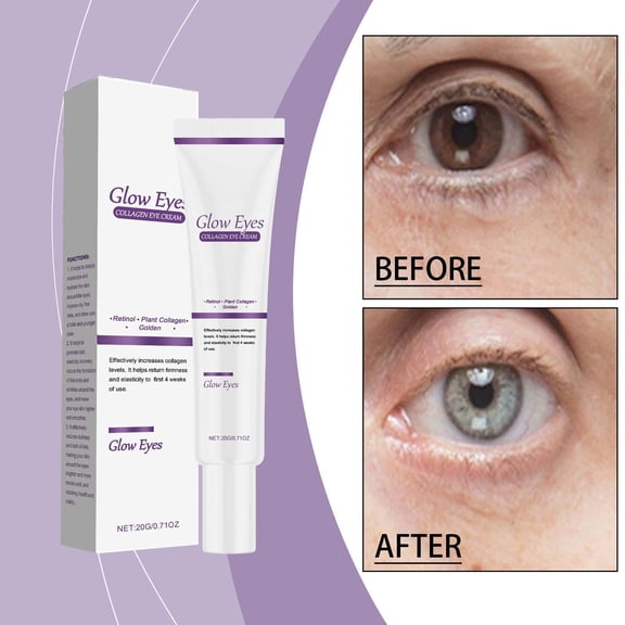 Collagen Eye Cream - Hydrating & Nourishing Under-Eye Treatment - Gentle Formula for Delicate Eye Area
