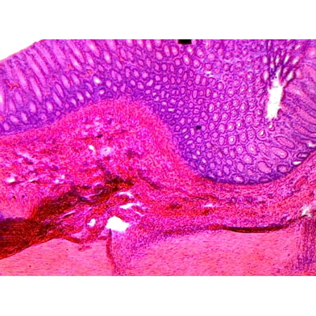 Colon, Mammalian; Showing Typical Histology Structures; Cross Section by Go Science Crazy