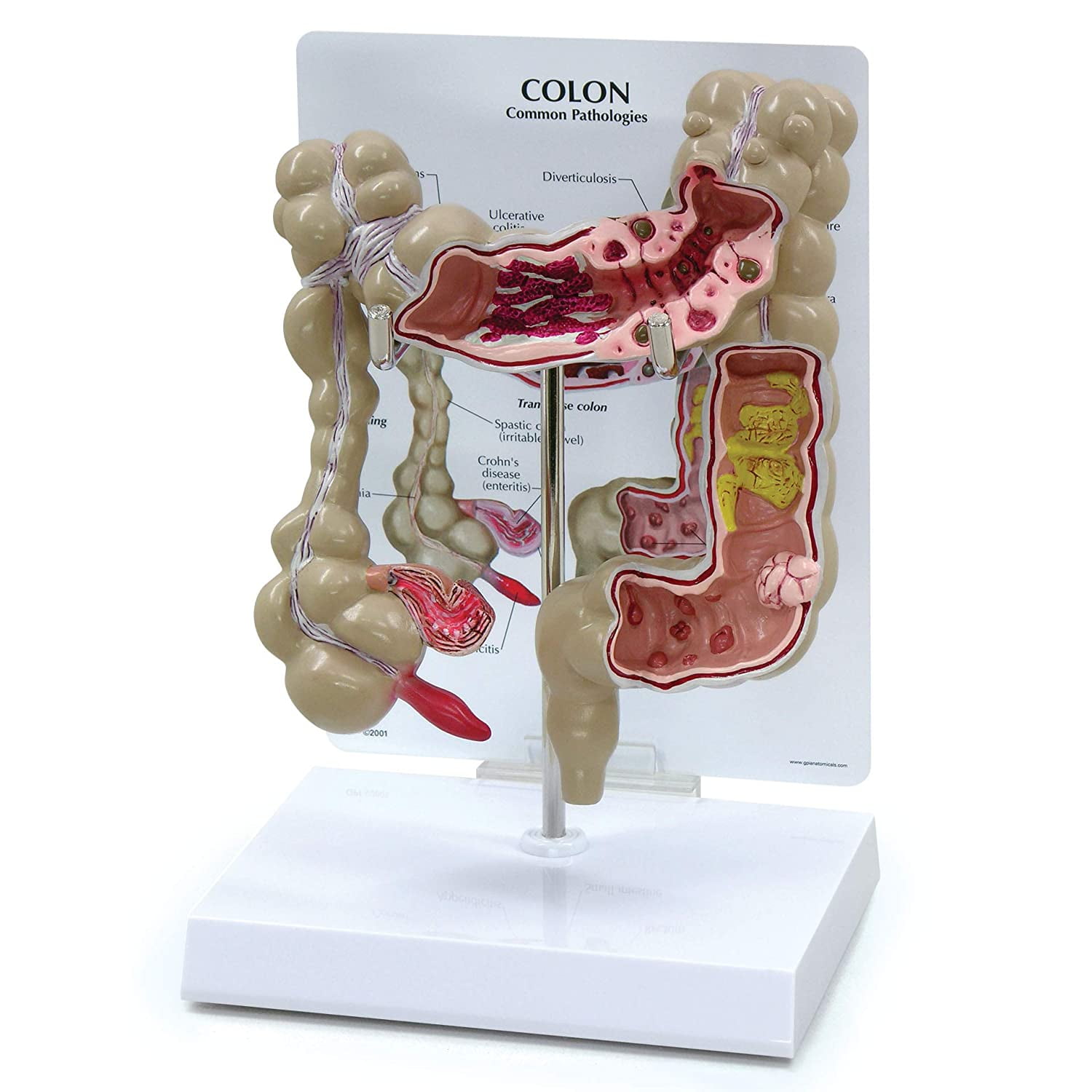 Colon Model, for Human Anatomy and Physiology Education, Anatomy Model ...