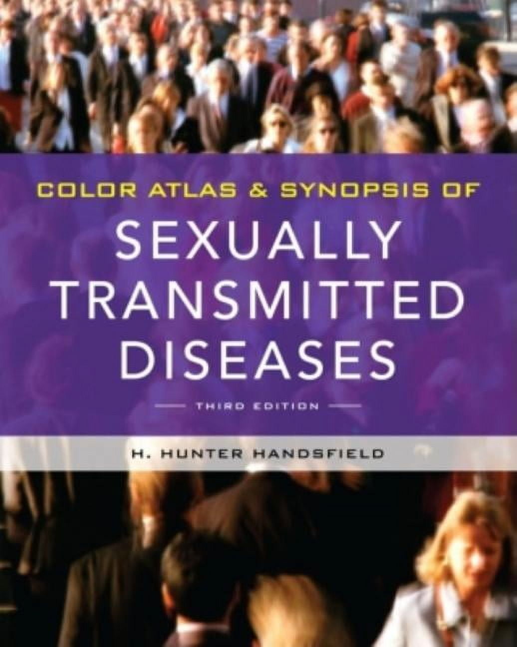 Color Atlas & Synopsis of Sexually Transmitted Diseases, (Paperback ...
