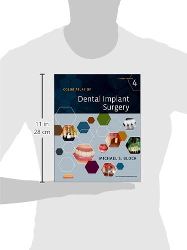 Pre-Owned Color Atlas of Dental Implant Surgery [Hardcover] Block DMD ...