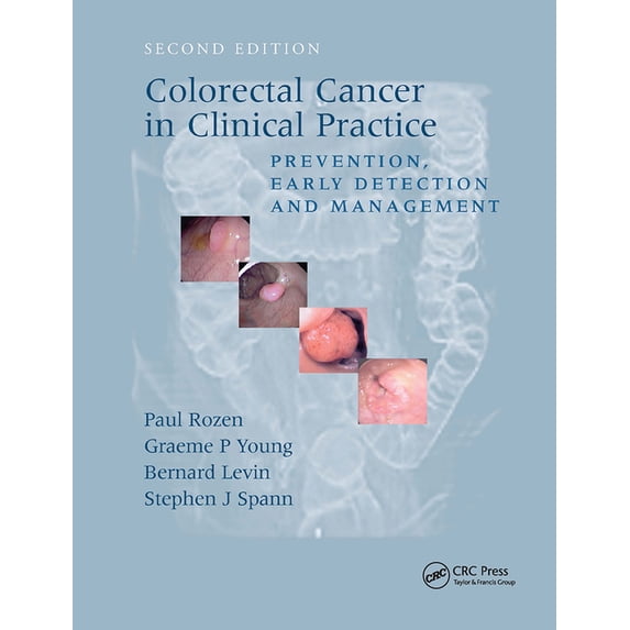 Colorectal Cancer in Clinical Practice: Prevention, Early Detection and Management, Second Edition (Paperback)