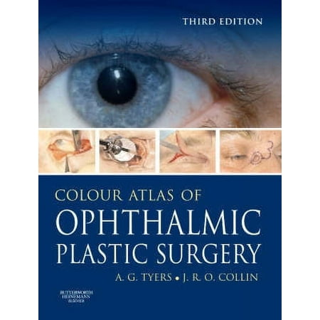 Colour Atlas of Ophthalmic Plastic Surgery with DVD