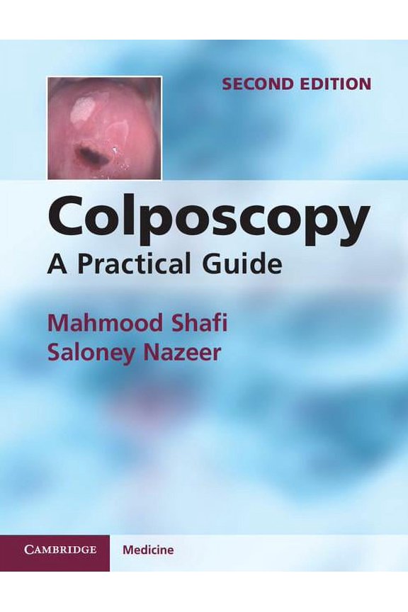 Colposcopy, (Paperback)