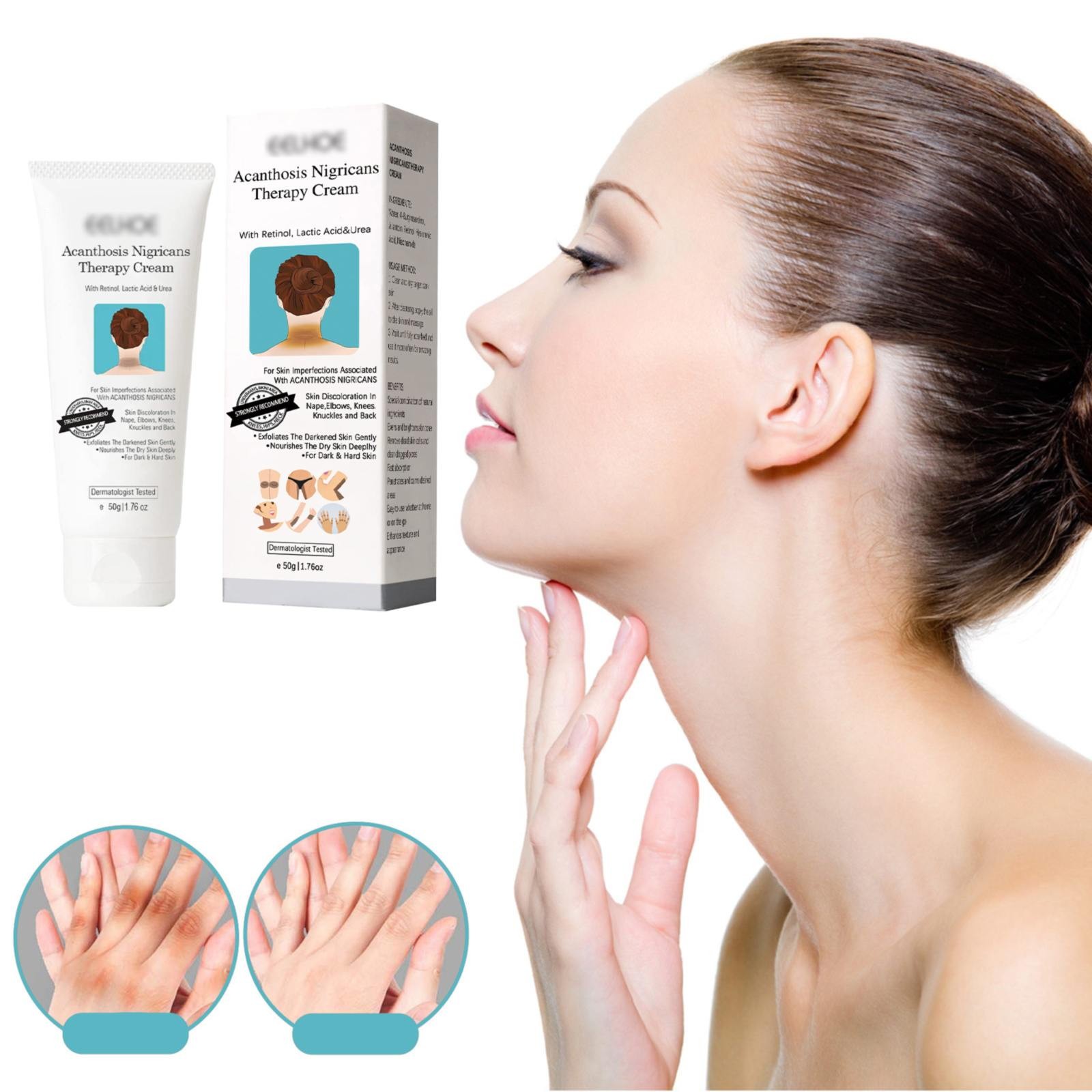 Come and Have a Look! Sujito Body Care System Care Lotion Acanthosis ...