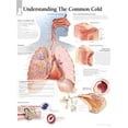 thumbnail image 1 of The Common Cold chart : Laminated Wall Chart (Wallchart), 1 of 2
