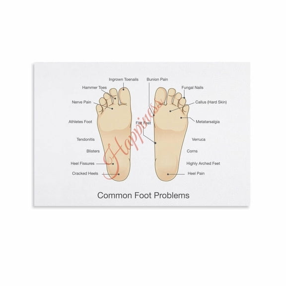 Common Foot Problems Chart Poster Foot Problems Podiatry Office Wall Art Canvas Painting Wall Art
