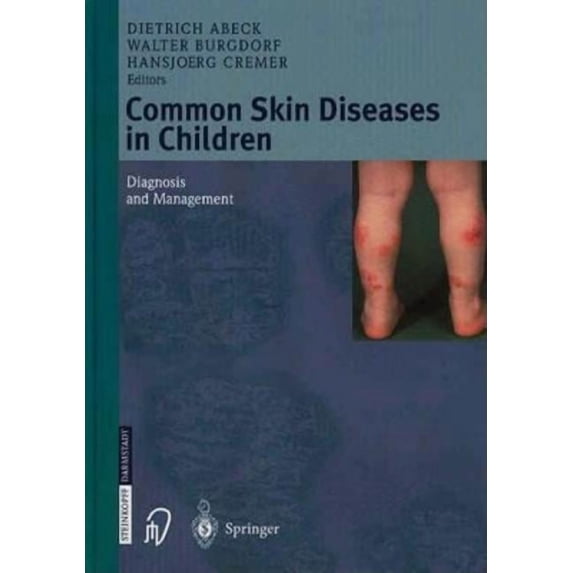 Common Skin Diseases in Children: Diagnosis and Management, (Hardcover)