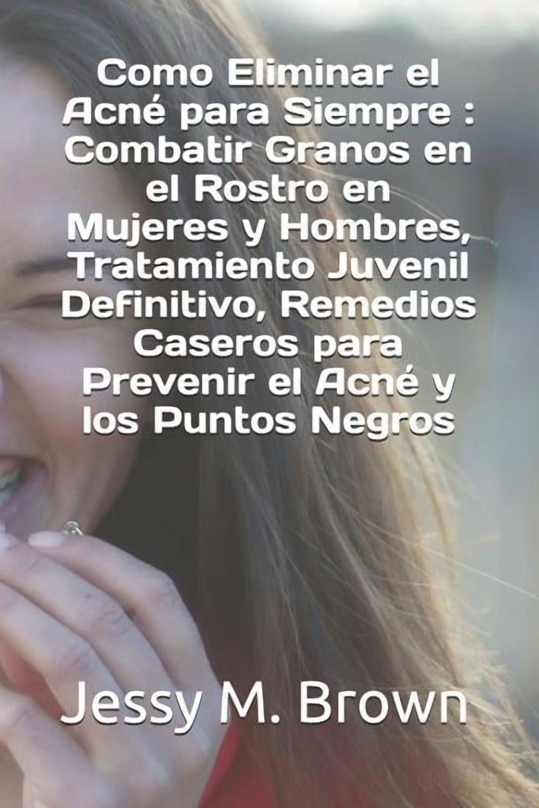 Como Eliminar el Acn para Siempre : Combatir Granos en el Rostro en Mujeres y Hombres, Tratamiento Juvenil Definitivo, Remedios Caseros para Prevenir el Acn y los Puntos Negros Spanis 1796546704