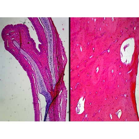 Compact Bone, Decalcified Preparation; Cross Section and Longitudinal Section