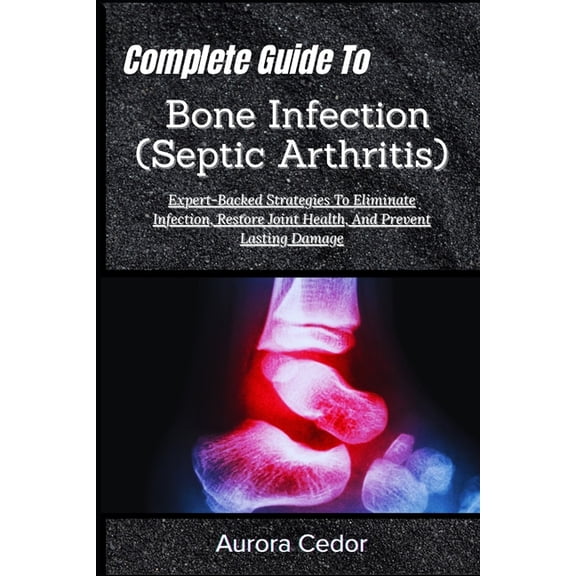 Complete Guide To Bone Infection (Septic Arthritis): Expert-Backed Strategies To Eliminate Infection, Restore Joint Heal, (Paperback)