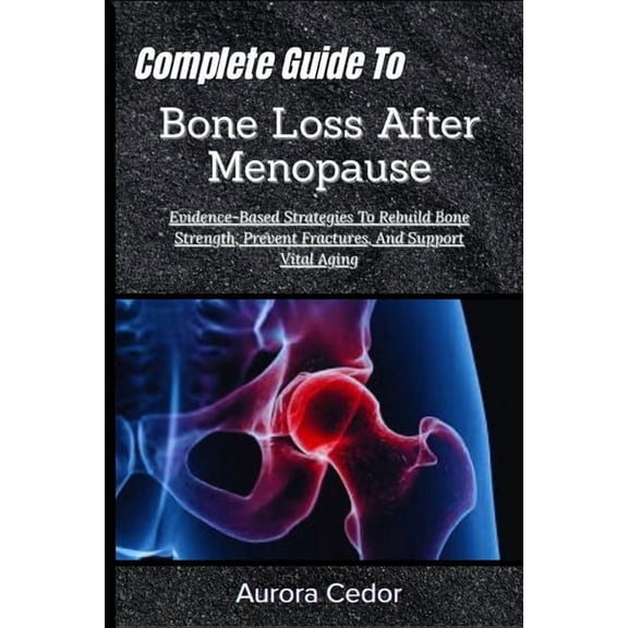 Complete Guide To Bone Loss After Menopause: Evidence-Based Strategies To Rebuild Bone Strength, Prevent Fractures, And , (Paperback)