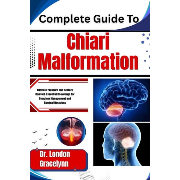 Complete Guide To Chiari Malformation: Alleviate Pressure and Restore Comfort: Essential Knowledge for Symptom Managemen, (Paperback)