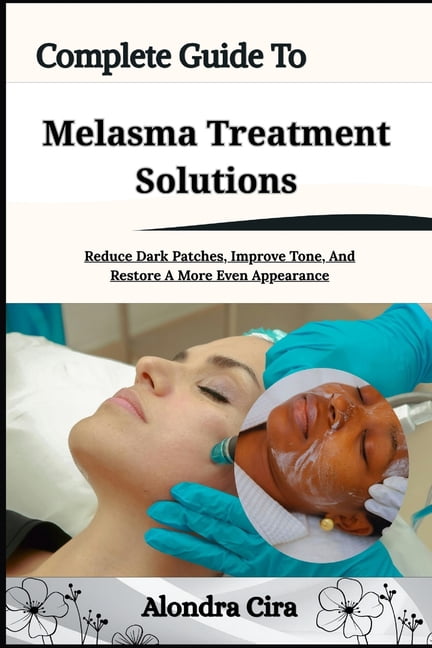 Complete Guide To Melasma Treatment Solutions: Reduce Dark Patches, Improve Tone, And Restore A More Even Appearance, (Paperback)