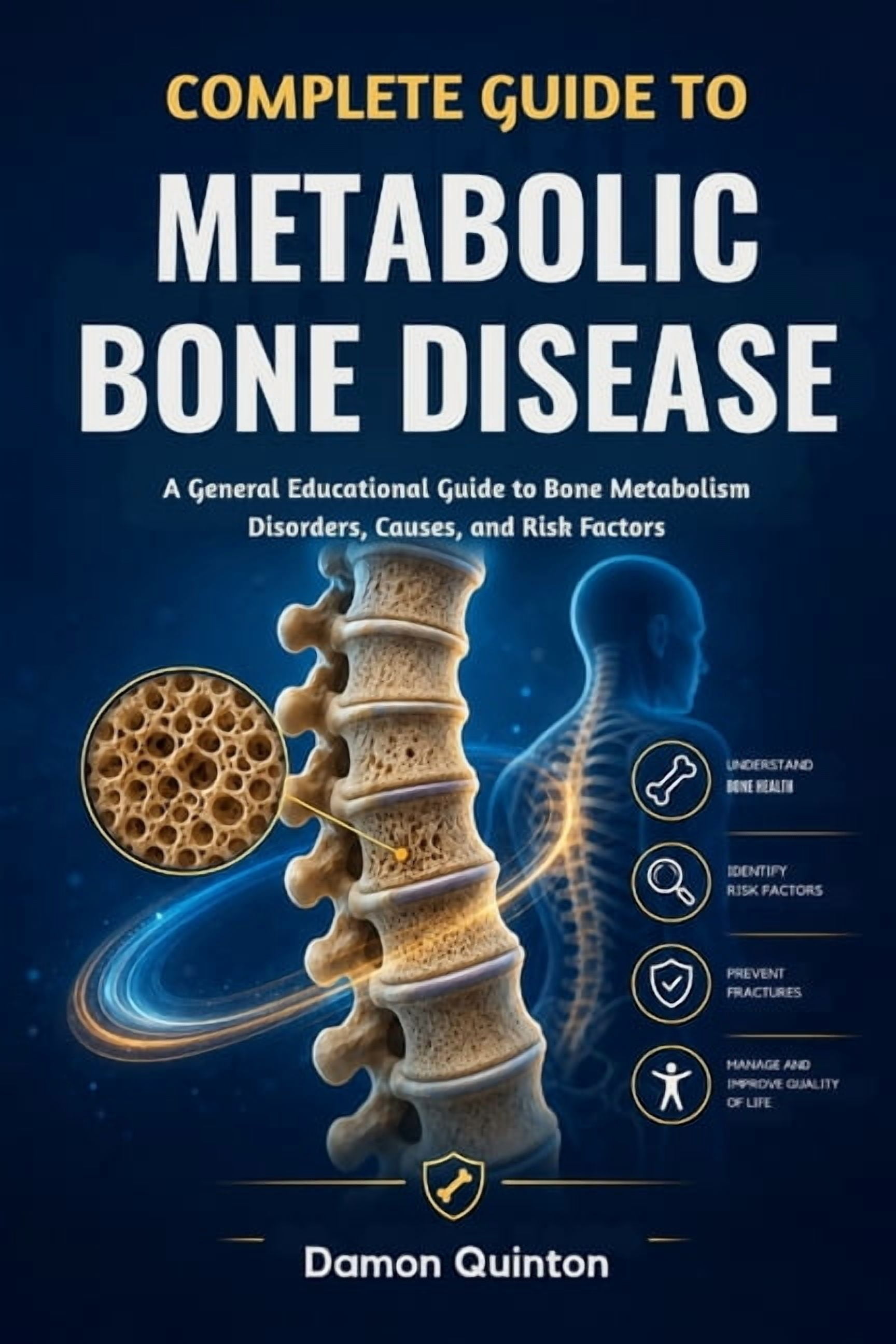 Complete Guide To Metabolic Bone Disease: A General Educational Guide to Bone Metabolism Disorders, Causes, and Risk Fac, (Paperback)