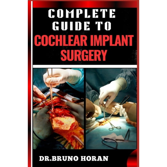 Complete Guide to Cochlear Implant Surgery: Comprehensive Manual To Advanced Techniques, Patient Care, And Optimized Out, (Paperback)