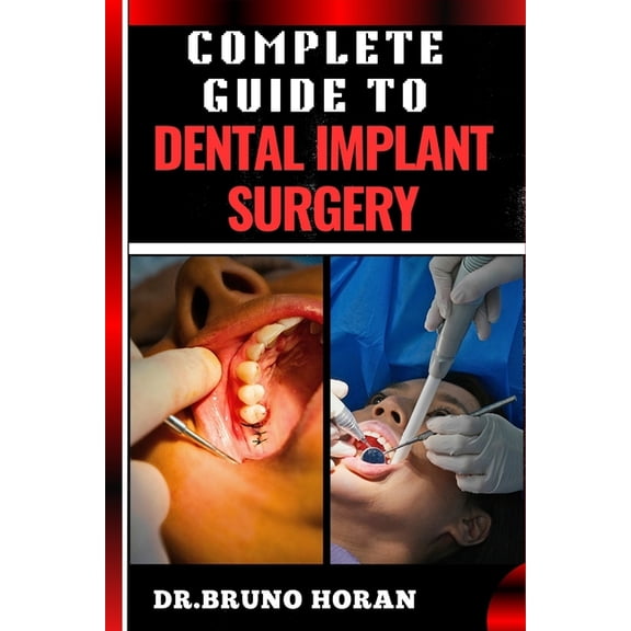 Complete Guide to Dental Implant Surgery: Comprehensive Manual To Advanced Techniques, Recovery, and Best Practices for , (Paperback)