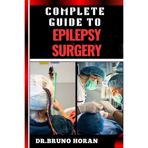 Complete Guide to Epilepsy Surgery: Comprehensive Handbook To Advanced Techniques, Patient Care, And Post-Surgical Outco, (Paperback)