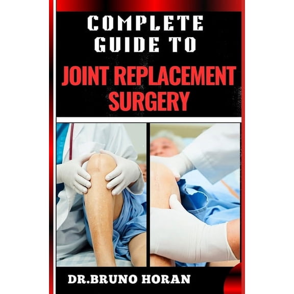 Complete Guide to Joint Replacement Surgery: Comprehensive Handbook To Recovery, Benefits, Risks, And Rehabilitation For, (Paperback)