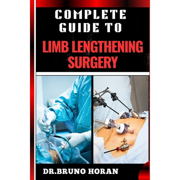 Complete Guide to Limb Lengthening Surgery: Essential Handbook To Modern Techniques, Recovery, And Best Practices For Op, (Paperback)