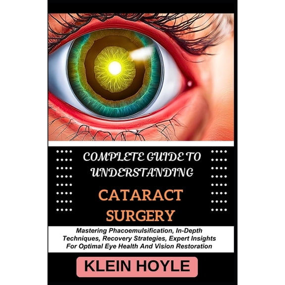 Complete Guide to Understanding Cataract Surgery: Mastering Phacoemulsification, In-Depth Techniques, Recovery Strategie, (Paperback)