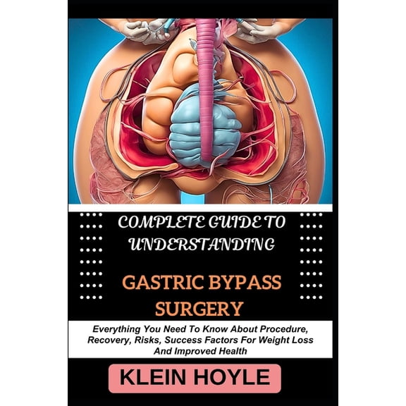 Complete Guide to Understanding Gastric Bypass Surgery: Everything You Need To Know About Procedure, Recovery, Risks, Su, (Paperback)