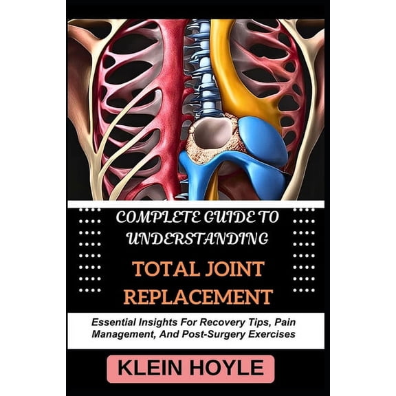 Complete Guide to Understanding Total Joint Replacement: Essential Insights For Recovery Tips, Pain Management, And Post, (Paperback)