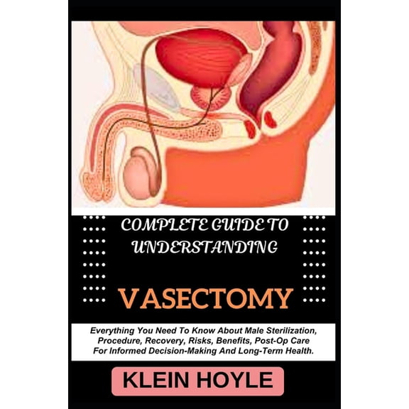 Complete Guide to Understanding Vasectomy: Everything You Need To Know About Male Sterilization, Procedure, Recovery, Ri, (Paperback)