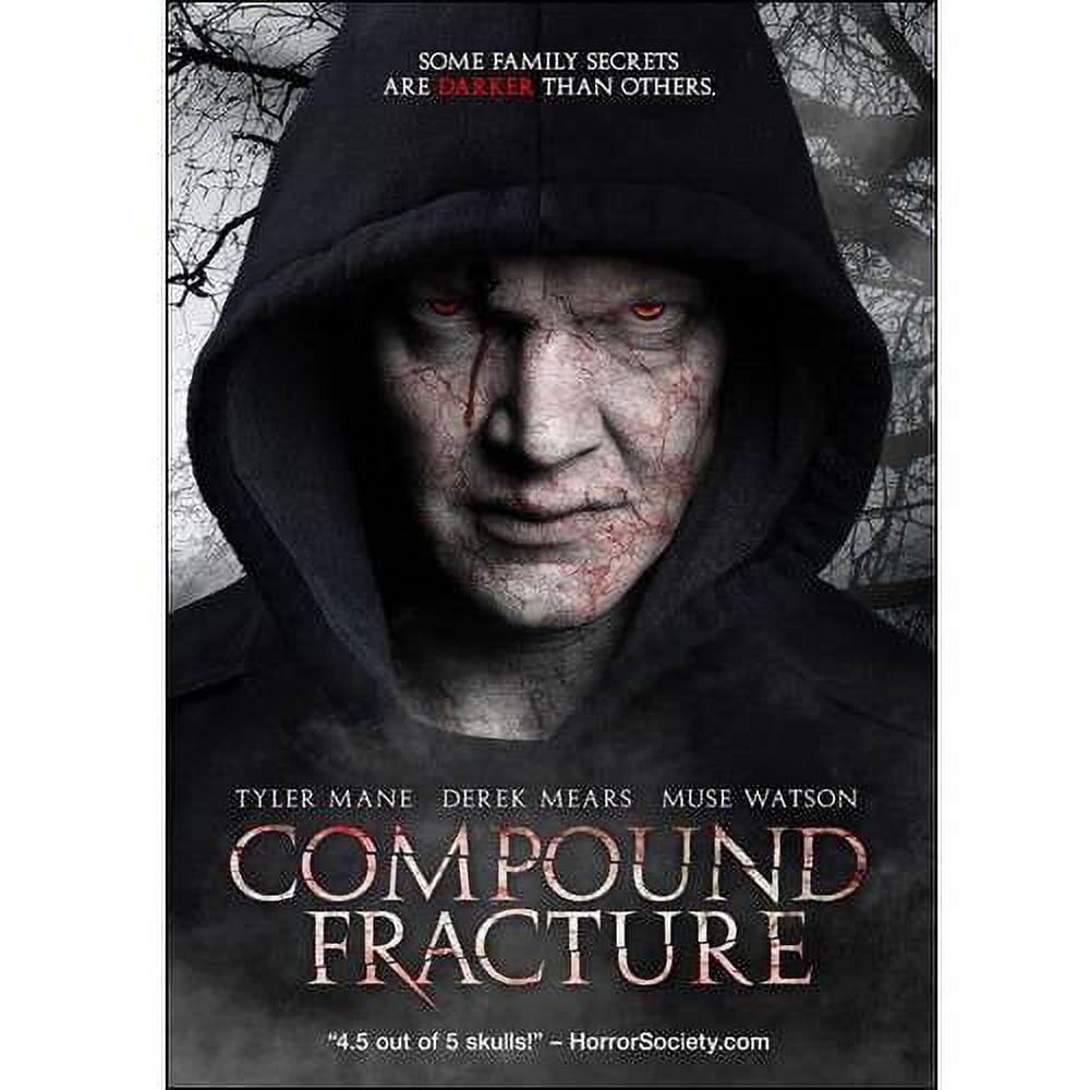 PreOwned Compound Fracture