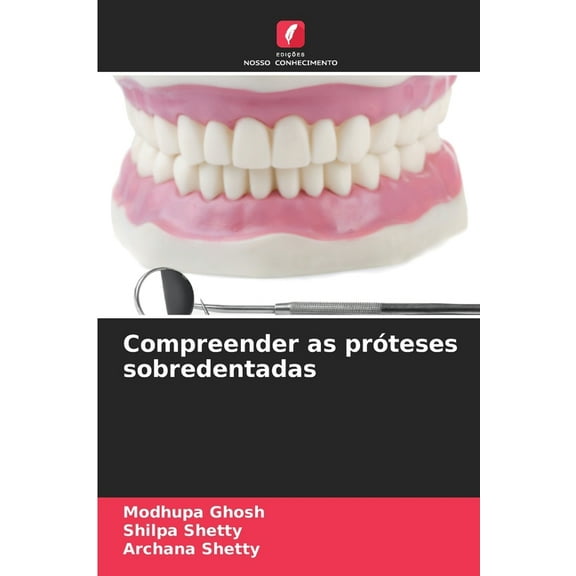 Compreender as prÃ³teses sobredentadas, (Paperback)