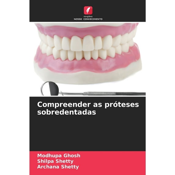 Compreender as próteses sobredentadas, (Paperback)